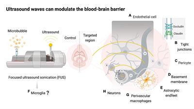 Using focused ultrasound to modulate microglial structure and function